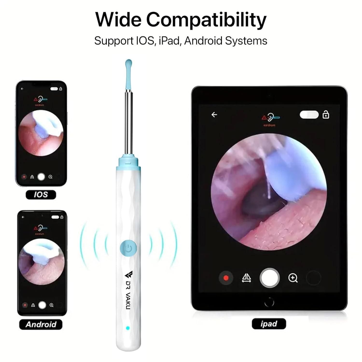 👂 Smart Visual Ear Wax Cleaner – See, Clean & Care with Confidence